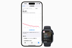 Apple Watchの「心房細動履歴」が日本でも利用可能に